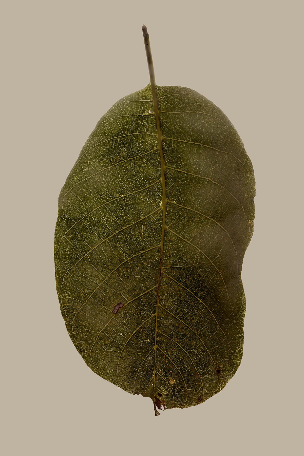 9315561